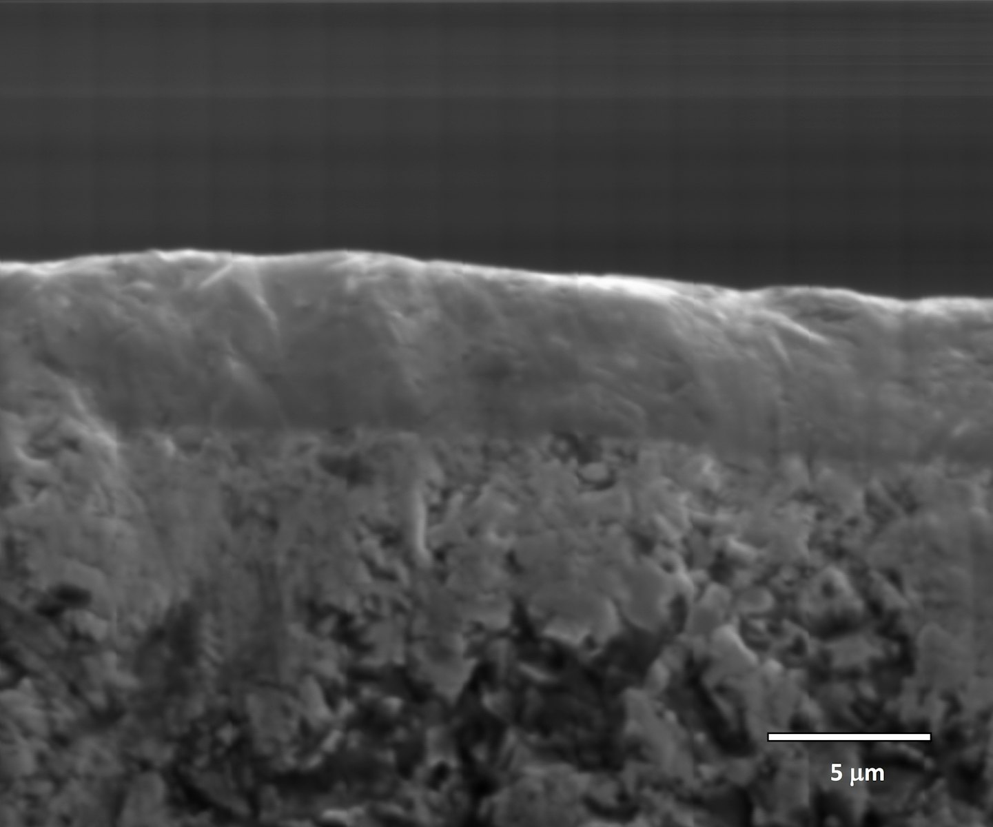 Microsection Ionbond 35